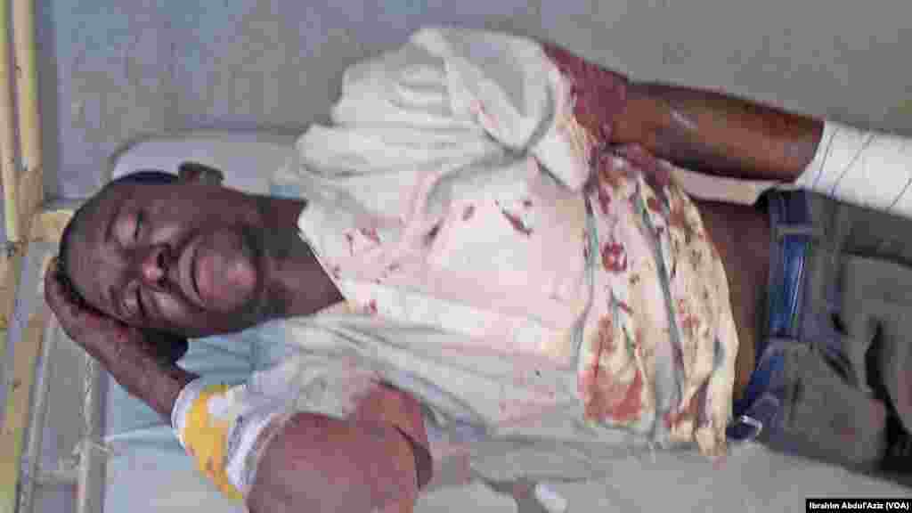 Wasu mutane da suka ji raunuka bayan harin 'yan bindiga da ake zaton Boko Haram ne a kauyen Chakawa ran 26 ga watan Junairu, 2014.