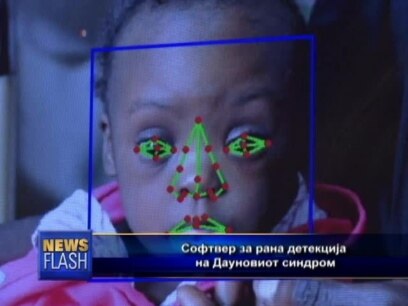 Рана детекција на Дауновиот синдром