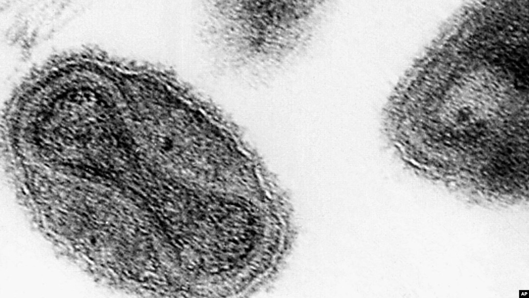 FILE -Smallpox virus