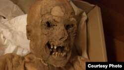 Hungarian mummies excavated from a church crypt in Hungary in 1995 are providing clues to the causes of colorectal cancer. (Photo - courtesy of Tel Aviv University)