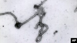 En la imagen, el virus del ébola visto en un microscopio.