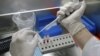 A medical laboratory assistant works in the flu virus lab of the Centre of Epidemiology in Budapest April 29, 2009. 