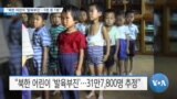 [VOA 뉴스] “북한 어린이 ‘발육부진’…5명 중 1명”