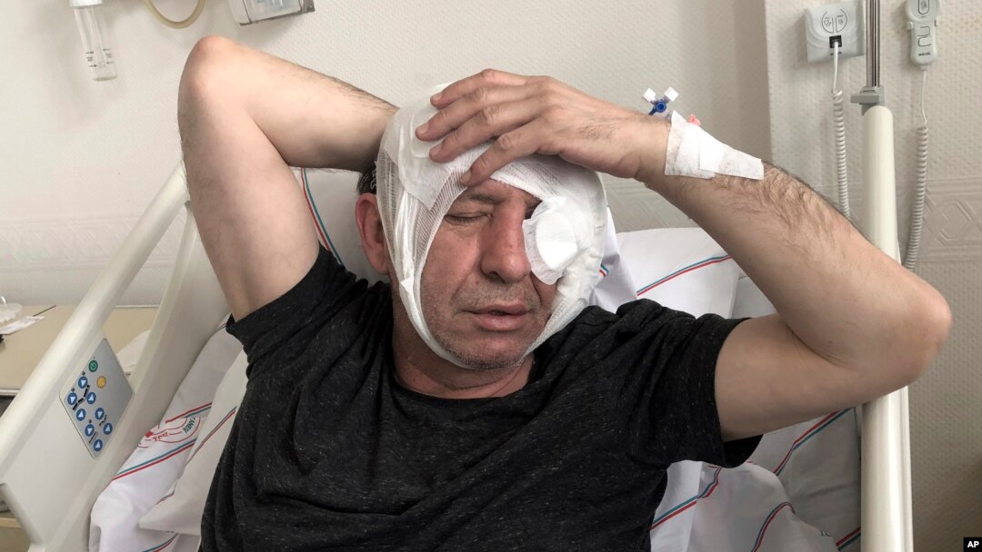 Yavuz Selim Demirag, wartawan Turki yang kritis terhadap pemerintahan Presiden Turki Recep Tayyip Erdogan dan sekutu-sekutu nasionalnya, beristirahat di rumah sakit di Ankara, 11 Mei 2019.
