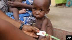 Enfant malnutri dans un camp de réfugiés à Yola au Nigeria, le 3 mai 2015 (AP /Sunday Alamba)