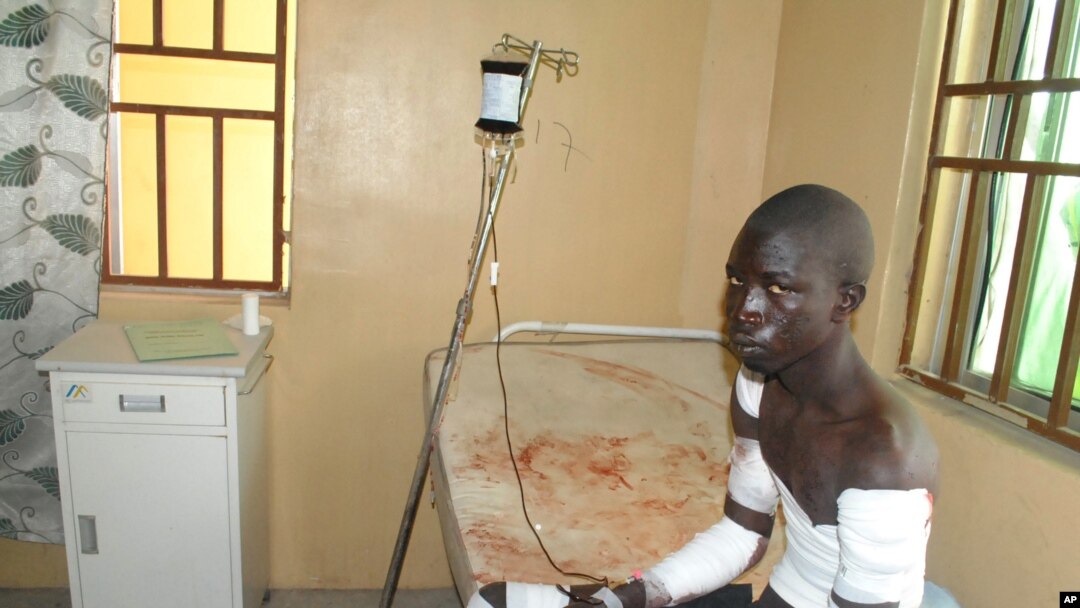 Korban serangan Boko Haram dirawat di sebuah rumah sakit di Maiduguri, Nigeria, 28 Desember 2015. 
