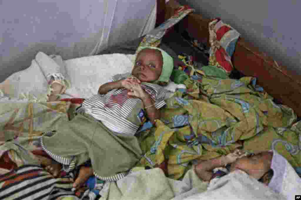 Two malnourished children rest at a local hospital in the small village of Walikale, Congo, Sunday, Sept. 19, 2010. First the rebel soldiers told residents of the villages in the mineral-rich eastern Congo not to worry. They were just there for a rest and