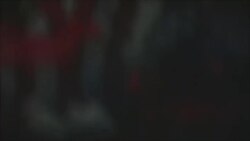 نن او وضعیت 