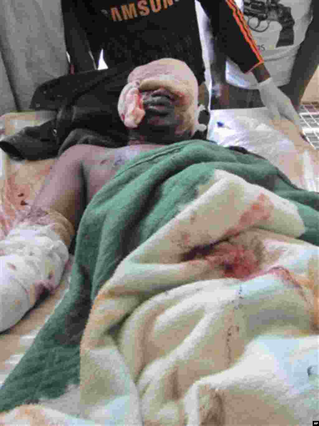 A victim of Friday's bomb blast and gun attacks lies in Murtala Muhammad specialist hospital in Kano, Nigeria Saturday, Jan. 21, 2012.