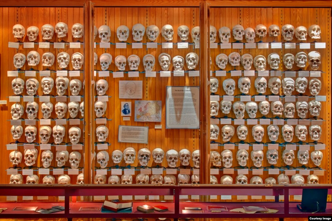 品質が完璧 Mütter Monstrosities Medical Showcases Museum アート写真