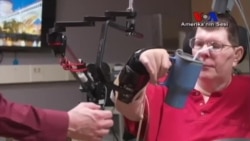 Yeni Teknolojiyle Felçli Hastalar Kollarını Hareket Ettirebiliyor