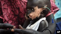 An infant with nasally inserted feeding tube at the nutrition center, Yida refugee camp, South Sudan, Dec. 12, 2011.