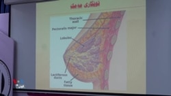   پسپۆڕانی تەندروستی پێشناری پشکنینی پێشوەختە بۆ خۆپارێزی لە شێرپەنجەی مەمک دەکەن 
