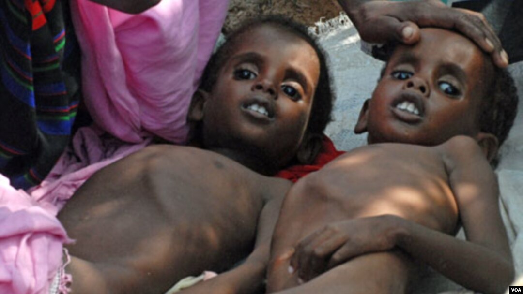 Dua anak Somalia yang menderita kurang gizi dirawat di kamp pengungsi di dekat bandara ibukota Mogadishu (18/7).