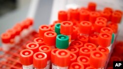 A laboratory technician prepares COVID-19 patient samples for semi-automatic testing at Northwell Health Labs, March 11, 2020, in Lake Success, N.Y.