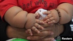 FILE - An eight-month-old boy is held by his mother as they wait to see a doctor at a clinic for the obese in Bogota, March 19, 2014.