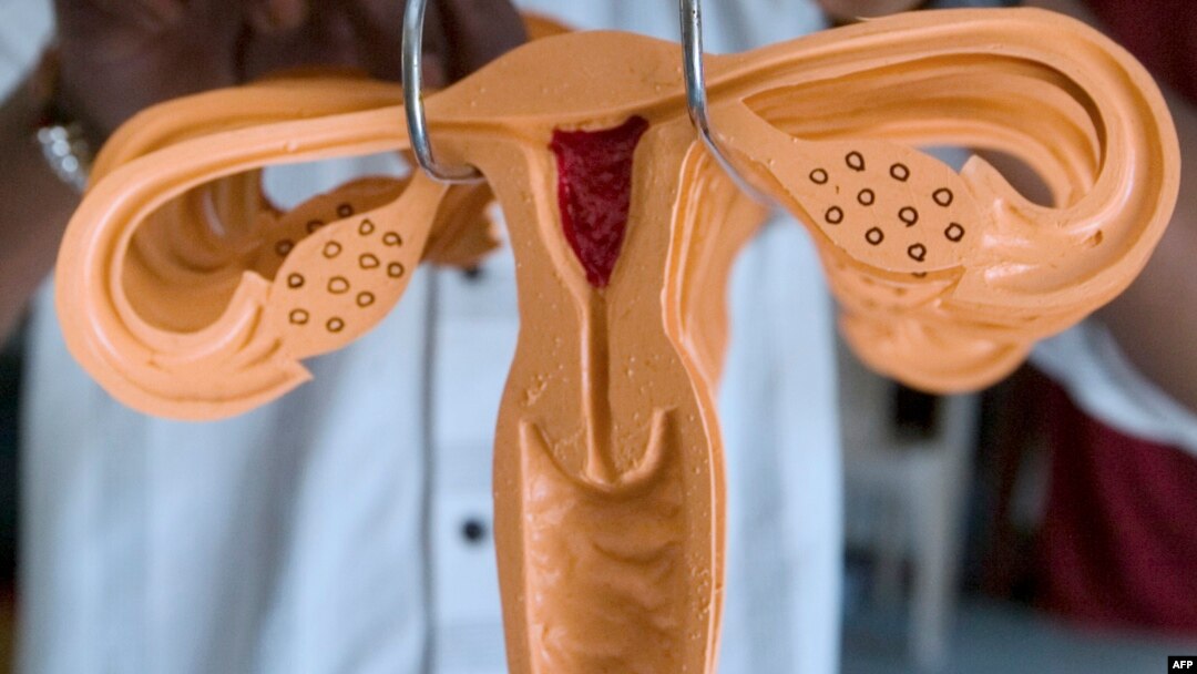 FILE - A life size rubber model of a uterus to be used as a health educational tool at a workshop in Sanand some 40 kms. from Ahmedabad. Surgeons in Cleveland say they have performed the nation's first uterus transplant, a new frontier that aims to give women who lack wombs a chance at pregnancy.