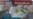 WHO Links COVID Pandemic, Disruption of Health Services