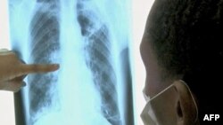 Analizë e re gjaku për zbulimin e sëmundjeve të mushkërive