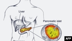 Trajtimi i kancerit në pankreas