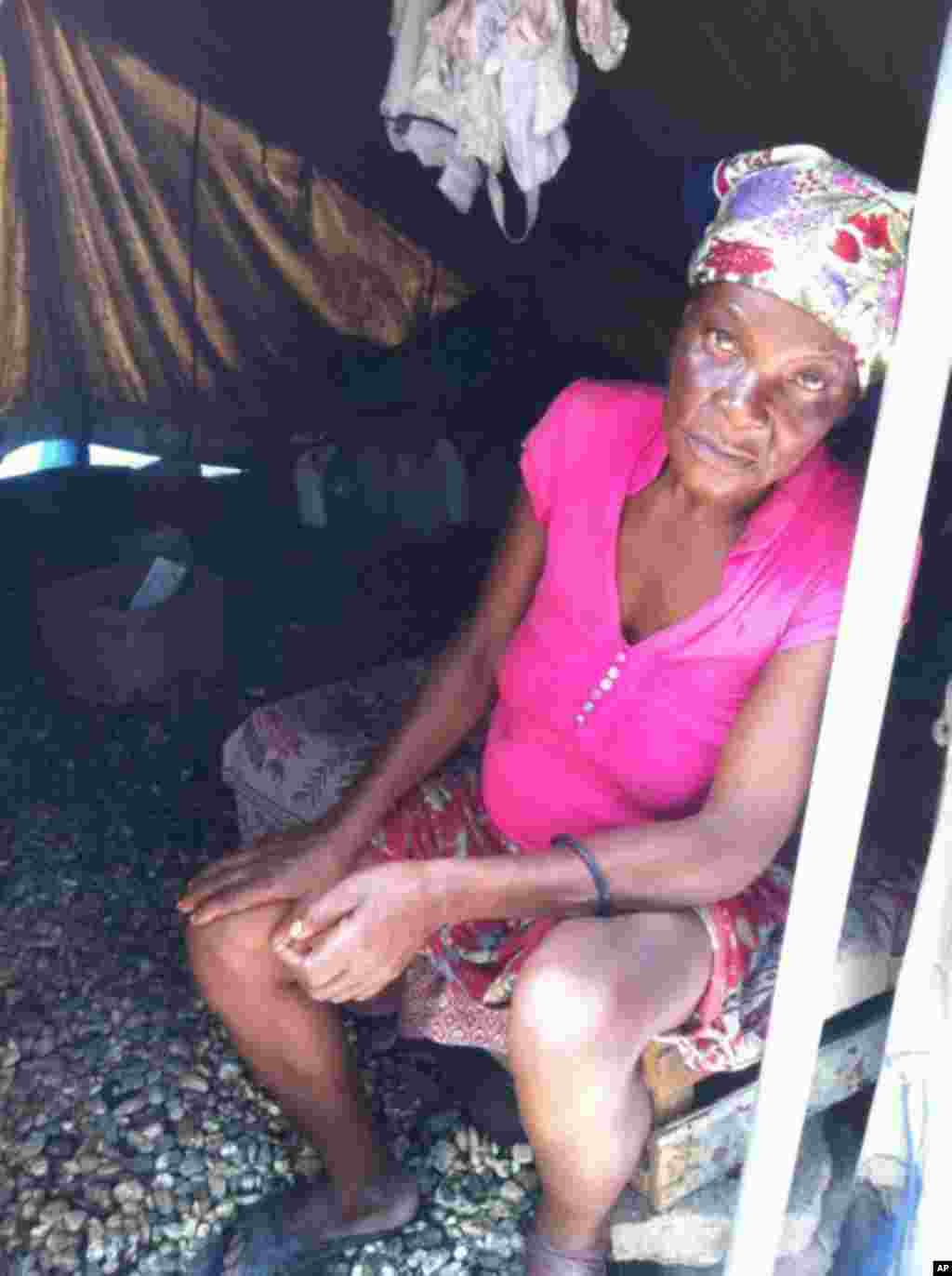 An earthquake survivor who now lives in a tent