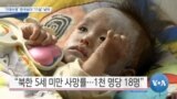 [VOA 뉴스] “‘결핵’ 세계 평균 4배…‘기대수명’ 한국 보다 ‘11살’ 낮아”