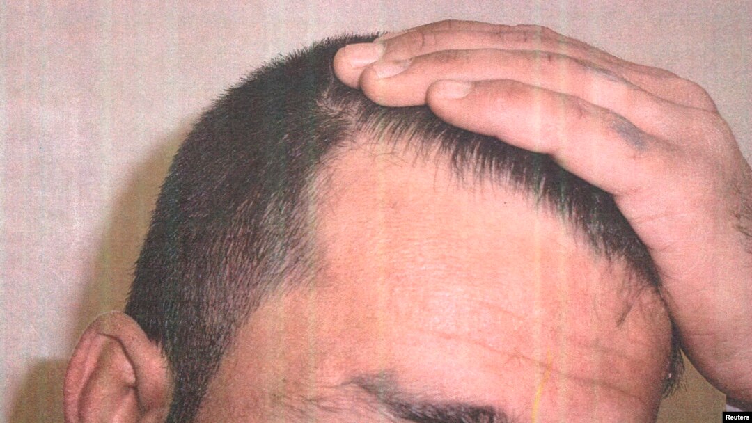 A detainee shows his scalp in an undated photo from Iraq's Abu Ghraib prison, among 198 images released in a Freedom of Information Act lawsuit against the U.S. Department of Defense in Washington, D.C., Feb. 5, 2016.