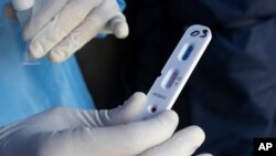 Un médico muestra una prueba rápida de coronavirus negativa en una carpa instalada a la entrada de un hospital en Caracas, Venezuela, el 15 de abril de 2020.