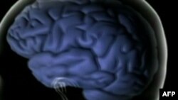 Bitkisel Hayatta Olduğu Sanılan Hastalarla İletişim Kurulabilir mi?