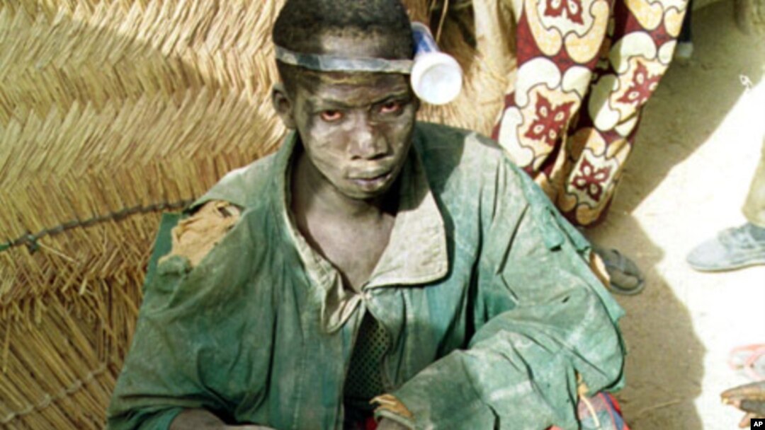 A 14-year-old boy with a pocket torch strapped to his head sits at the top of a gold mine-shaft.