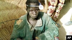 A 14-year-old boy with a pocket torch strapped to his head sits at the top of a gold mine-shaft.