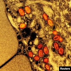 FILE - Colorized transmission electron micrograph of mpox virus particles captured at the NIAID Integrated Research Facility in Fort Detrick, Maryland. (NIAID/Handout via REUTERS)