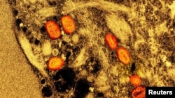 An undated colorized electron micrograph of mpox virus particles (red) found within an infected cell (brown) cultured in the laboratory, captured at the National Institute of Allergy and Infectious Diseases in Fort Detrick, Maryland. (NIAID via Reuters)