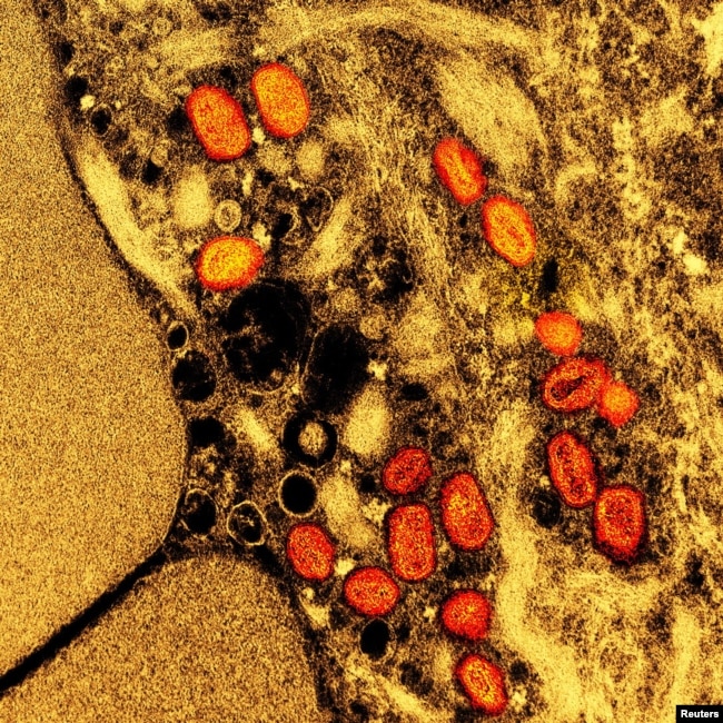 FILE - Colorized transmission electron micrograph of mpox virus particles captured at the NIAID Integrated Research Facility in Fort Detrick, Maryland. (NIAID/Handout via REUTERS)