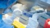 EE.UU.: Estudio de UCLA indica que infectados pierden rápidamente anticuerpos contra coronavirus