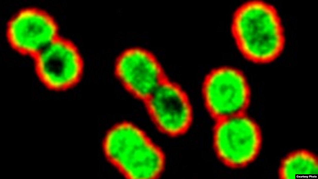 Bakteri Acinetobacter baumannii dimatikan oleh azithromycin (hijau). (Foto: UC-San Diego School of Medicine)