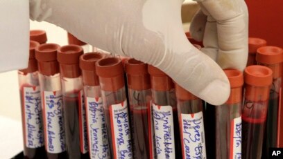 Qiziqish uchun porno rasmlar