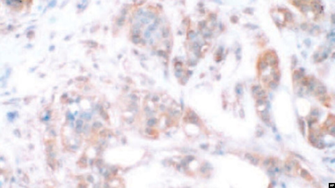 Cancer is really dozens of different diseases and finding commonalities among them could bring scientists closer to finding a cure.