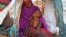 FILE - A displaced Somali mother comforts her malnourished child in their makeshift shelter at a camp in the Garasbaley area on the outskirts of Mogadishu, Somalia, March 28, 2017.