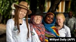 FILE - Albino women in Dar es Salaam, Tanzania. 