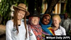 FILE: This image courtesy of the Milliyet Daily shows albino women posing on May 5, 2014, in Dar es Salaam. The Tanzanian government has openined shelters for albino children in some parts of the country and commissioning task forces to investigate albino killings.
