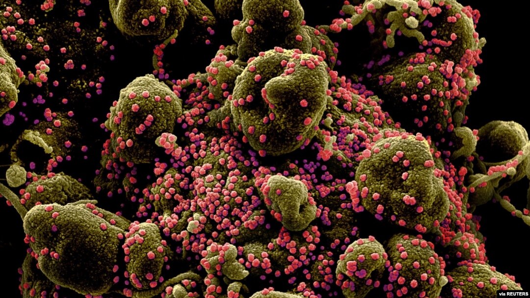Célula fuertemente infectada con partículas del virus SARS-COV-2, también conocido como el nuevo coronavirus. [Foto de archivo]
