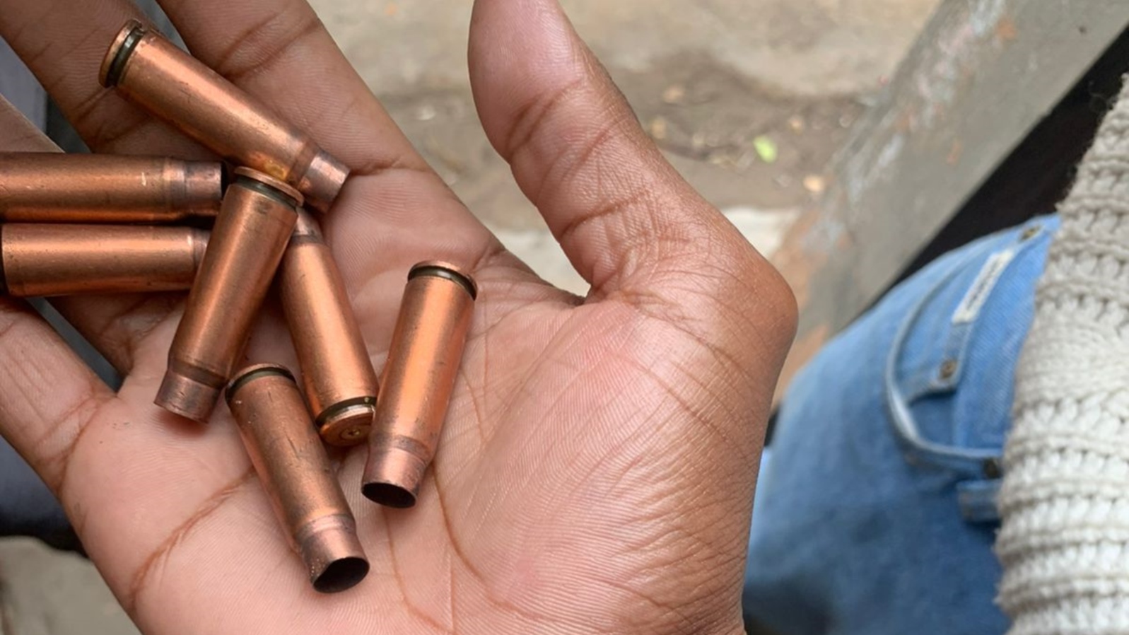 Um manifestante mostra as balas reais atiradas pela polícia durante a manifestação, Novembro, 2024