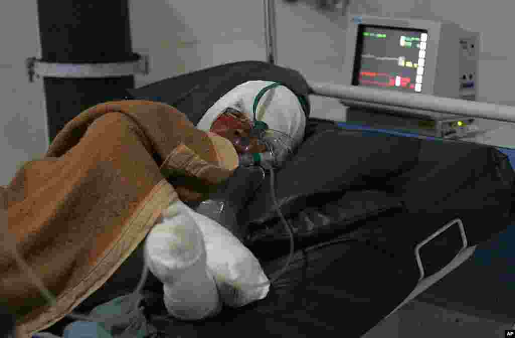 Afghan woman Ghodsi, (20), who committed self-immolation and has been hospitalized since last week with 85 percent of her body covered in burns, at Herat hospital. Ghodsi was forced to marry an elder man two years ago and attempted suicide after acknowle