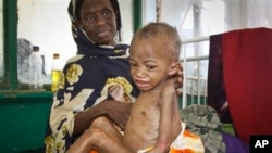 Abdulahi Musa, a malnourished five-year-old boy, sits on his mother's lap at Banadir hospital in Mogadishu, Somalia Tuesday, May 20, 2014. Much of Somalia has seen no or erratic rains in recent months and fighting between African Union forces and the Islamic extremists of al-Shabab is cutting off food shipments to many parts of the country and discouraging farmers from planting - as a result, 50,000 children are severely malnourished, says the aid community. (AP Photo/Farah Abdi Warsameh)