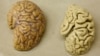 Cooling Brain Protein Could Aid Search for Alzheimer's Treatment