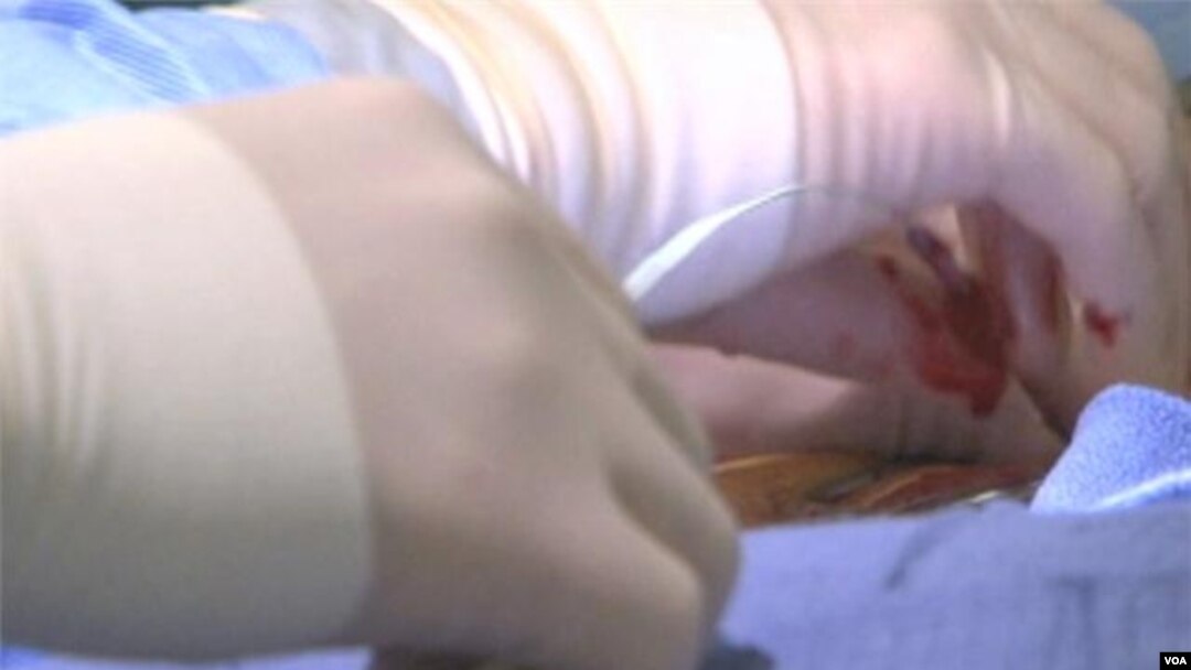 Pakistan memeriksa kesehatan pasien penderita jantung terkait penggunaan obat (Foto: dok).