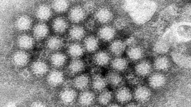 ¿Qué es el norovirus y por qué preocupa esta temporada en EEUU?