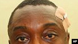 An unidentified victim sits on a bed at the National hospital in Abuja.