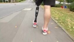 Chân giả thông minh giúp người khuyết tật dễ đi lại